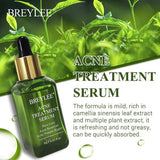 Skin Care Whitening Repair Pimple Remover For Acne