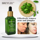 Skin Care Whitening Repair Pimple Remover For Acne